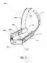 Fig. 06 - Heel stabilization device