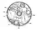 Fig. 01 - Programmable implantable pump design