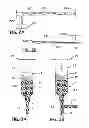 Fig. 03 - Systems and methods of delivering a dilated slurry to a patient