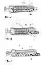 Fig. 07 - Systems and methods of delivering a dilated slurry to a patient