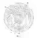 Fig. 09 - Medical device control handle with multiple puller wires