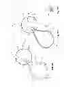 Fig. 06 - ENDOSCOPIC GUIDE WIRE TRACK