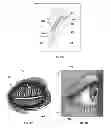 Fig. 02 - Dry eye treatment systems