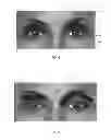 Fig. 07 - Dry eye treatment systems