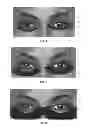 Fig. 08 - Dry eye treatment systems