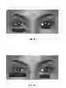 Fig. 09 - Dry eye treatment systems