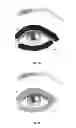 Fig. 12 - Dry eye treatment systems