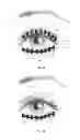 Fig. 14 - Dry eye treatment systems