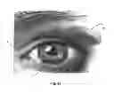 Fig. 15 - Dry eye treatment systems