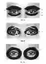 Fig. 17 - Dry eye treatment systems