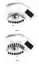 Fig. 18 - Dry eye treatment systems