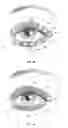 Fig. 20 - Dry eye treatment systems