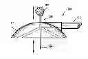 Fig. 01 - System for providing continual drainage in negative pressure wound therapy