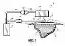 Fig. 02 - System for providing continual drainage in negative pressure wound therapy