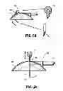 Fig. 06 - System for providing continual drainage in negative pressure wound therapy