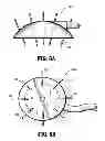 Fig. 07 - System for providing continual drainage in negative pressure wound therapy