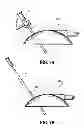 Fig. 08 - System for providing continual drainage in negative pressure wound therapy