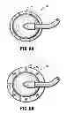 Fig. 09 - System for providing continual drainage in negative pressure wound therapy