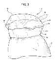 Fig. 04 - Protective undergarment using improved hook and loop fasteners