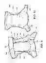 Fig. 10 - Protective undergarment using improved hook and loop fasteners