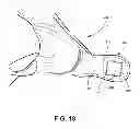 Fig. 19 - Protective undergarment using improved hook and loop fasteners