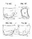 Fig. 23 - Protective undergarment using improved hook and loop fasteners