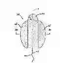 Fig. 01 - Fluid management device with fluid transport element for use within a body
