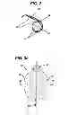 Fig. 03 - Fluid management device with fluid transport element for use within a body