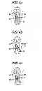 Fig. 05 - Fluid management device with fluid transport element for use within a body