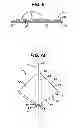 Fig. 07 - Fluid management device with fluid transport element for use within a body