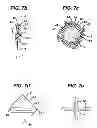 Fig. 08 - Fluid management device with fluid transport element for use within a body