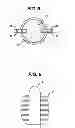 Fig. 09 - Fluid management device with fluid transport element for use within a body