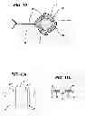 Fig. 10 - Fluid management device with fluid transport element for use within a body