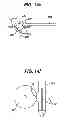 Fig. 14 - Fluid management device with fluid transport element for use within a body