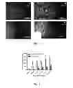 Fig. 06 - Devices, systems, and methods for excavating cancer cells