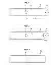 Fig. 02 - Neural injection system and related methods