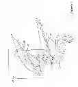 Fig. 02 - Biliary access catheter system and methods for accessing the biliary tree
