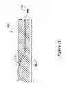 Fig. 06 - Biliary access catheter system and methods for accessing the biliary tree