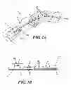 Fig. 02 - Methods and devices for applying closed incision negative pressure wound therapy
