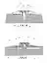 Fig. 08 - Methods and devices for applying closed incision negative pressure wound therapy