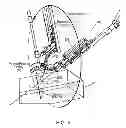 Fig. 07 - Method of making reduced backlash joint