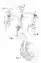 Fig. 02 - SURGICAL INSTRUMENT IN PARTICULAR FOR PERITONEAL SURGERY