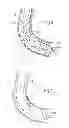 Fig. 04 - SURGICAL INSTRUMENT IN PARTICULAR FOR PERITONEAL SURGERY