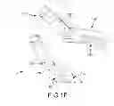 Fig. 07 - Stabilized ablation systems and methods