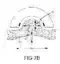 Fig. 22 - Stabilized ablation systems and methods