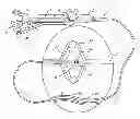 Fig. 01 - Method and apparatus for inflating and deflating balloon catheters