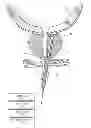 Fig. 01 - Systems and Methods for Treatment of Prostatic Tissue