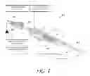 Fig. 02 - Systems and Methods for Treatment of Prostatic Tissue