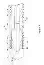 Fig. 04 - RENAL NERVE MODULATION MEDICAL DEVICES