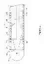 Fig. 05 - RENAL NERVE MODULATION MEDICAL DEVICES